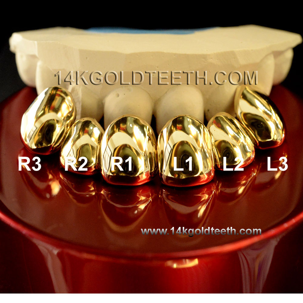 Silver Plated 18k Gold Teeth Single Cap Grillz - Y 80001