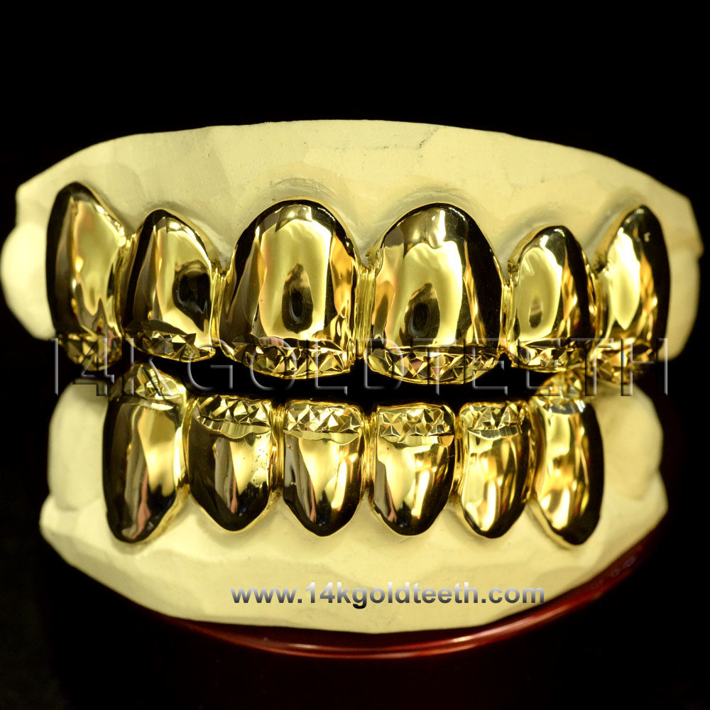 Top & Bottom Yellow Gold Teeth Grillz - TBY 30021