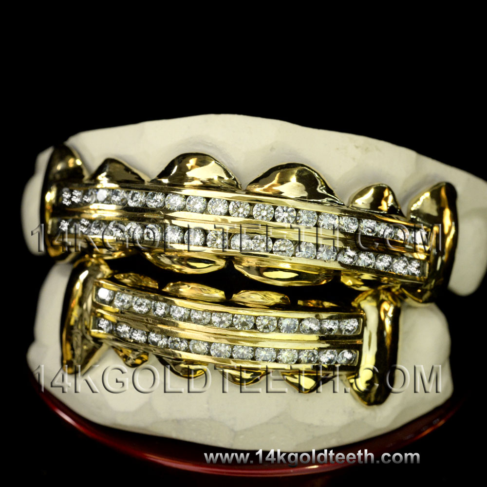 Iced Out  Yellow Gold Teeth Grillz - IC 40001