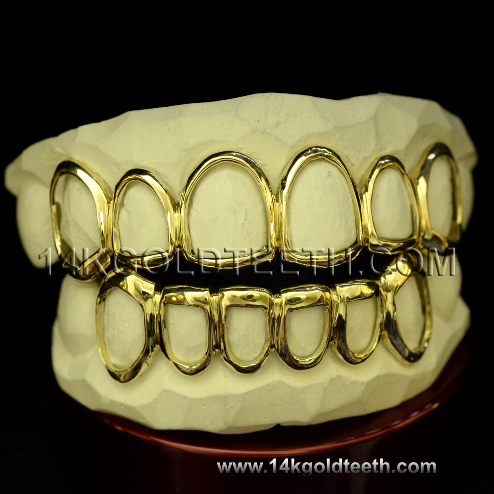 Top & Bottom Yellow Gold Teeth Grillz - TBY 30016