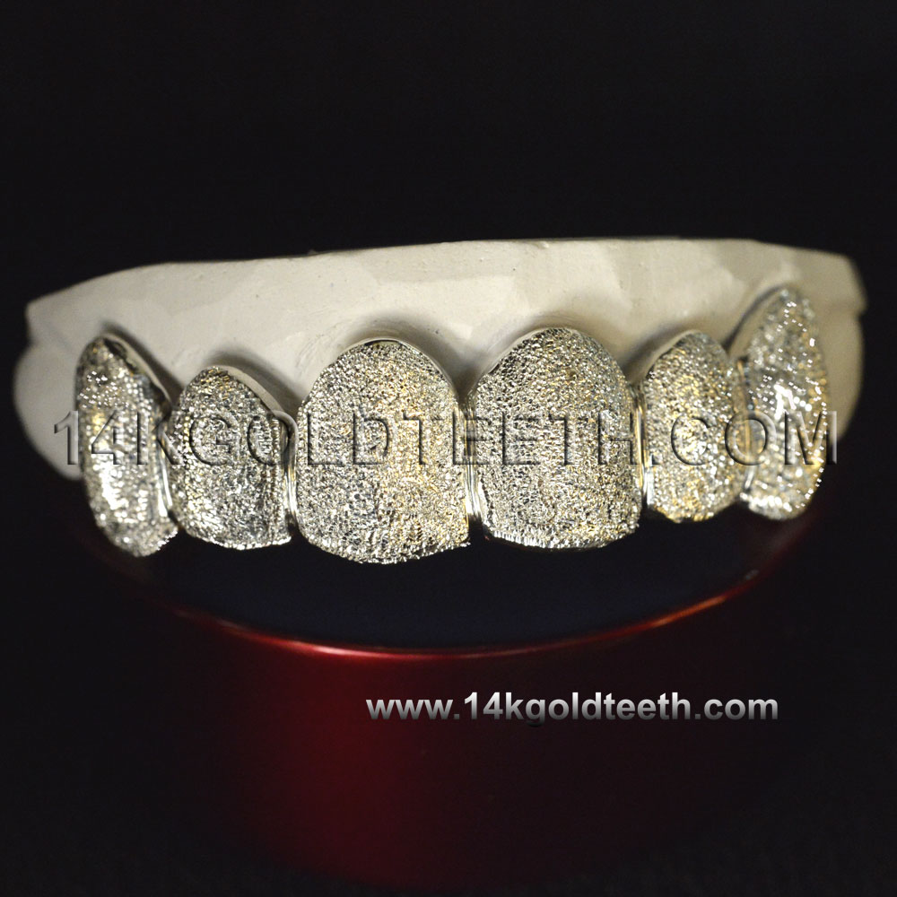 Top White Gold Teeth Grillz - TW 10202