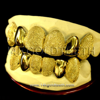Diamond Dust Yellow Gold Teeth Grillz - DD 90009