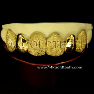 Diamond Dust Yellow Gold Teeth Grillz - DD 90009
