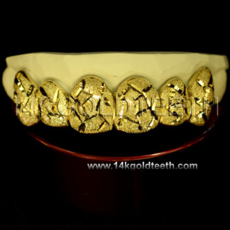 Diamond Dust Yellow Gold Teeth Grillz - DD 90008