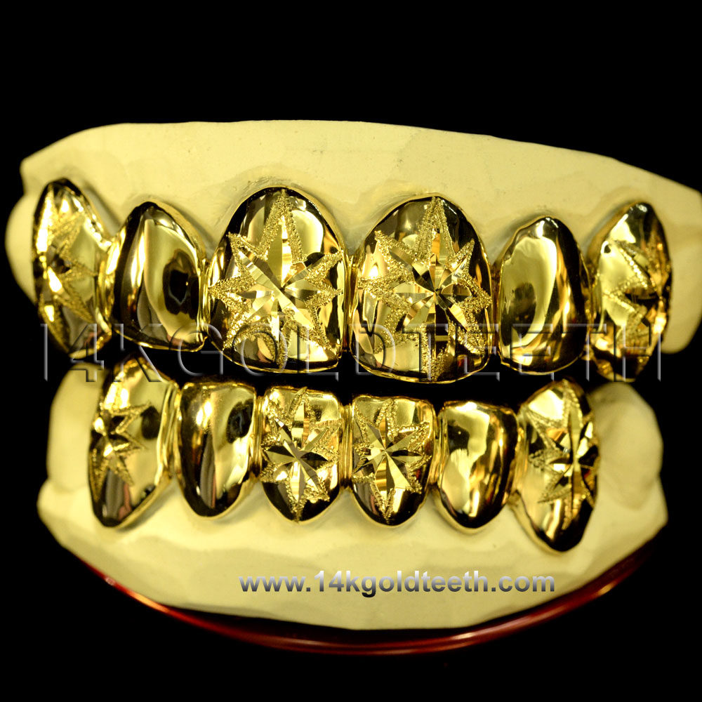 Top & Bottom Yellow Gold Teeth Grillz - TBY 30019