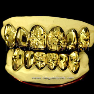 Diamond Dust Yellow Gold Teeth Grillz - DD 90005