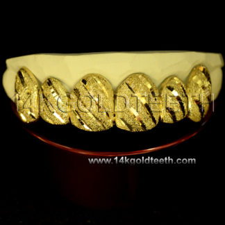 Diamond Dust Yellow Gold Teeth Grillz - DD 90001