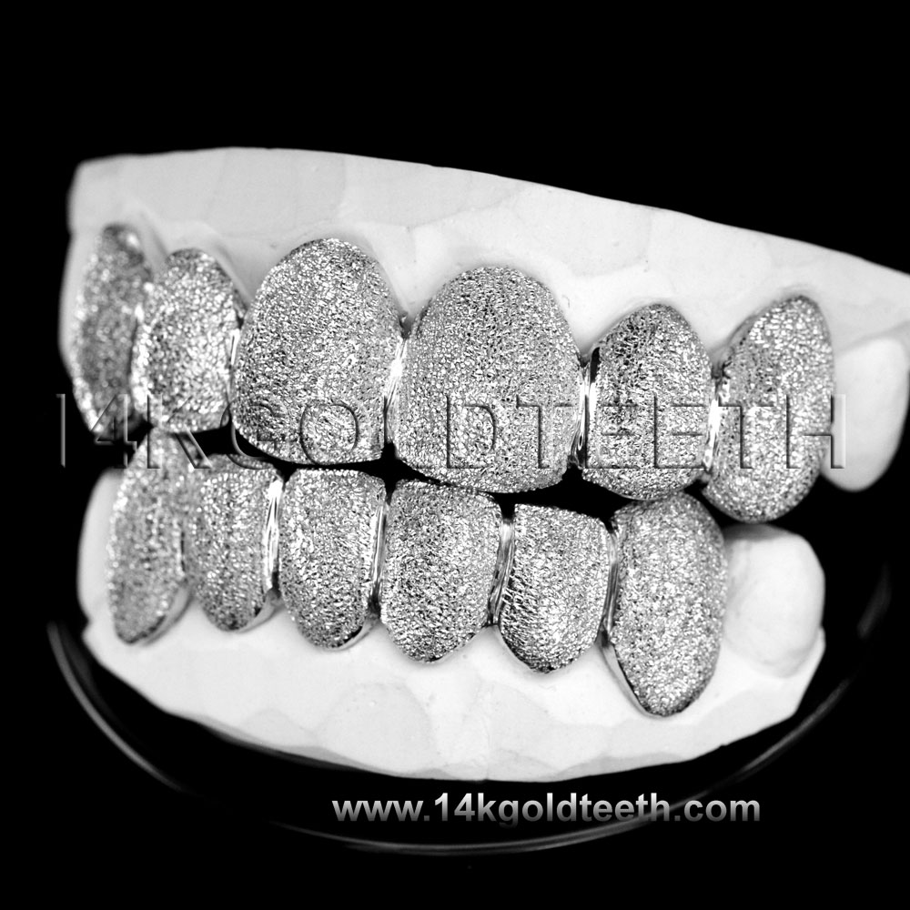 Top & Bottom White Gold Teeth Grillz - TBW 30224