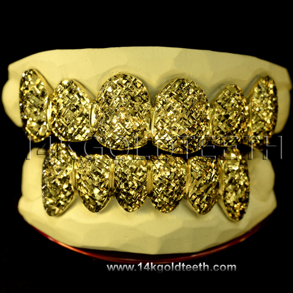 Top & Bottom Yellow Gold Teeth Grillz - TBY 30012