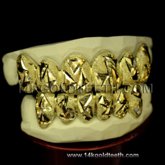 Top & Bottom Yellow Gold Teeth Grillz - TBY 30001
