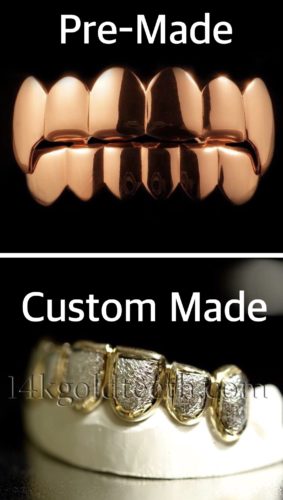 Difference between Pre-Made Grillz and Custom Grillz