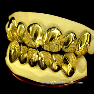 Top & Bottom Yellow Gold Teeth Grillz - TBY 30007