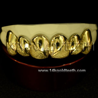 Diamond Dust Yellow Gold Teeth Grillz - DD 90013