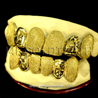 Diamond Dust Yellow Gold Teeth Grillz - DD 90017