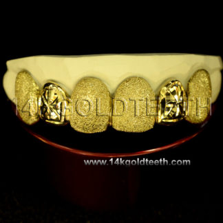 Diamond Dust Yellow Gold Teeth Grillz - DD 90017