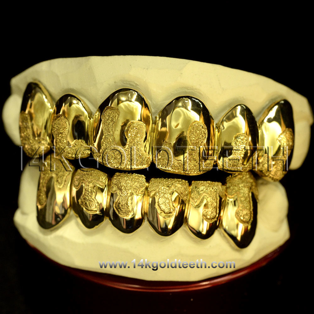 Silver Diamond Dust Drip Grillz with 18k Yellow Gold Plated - SP 107