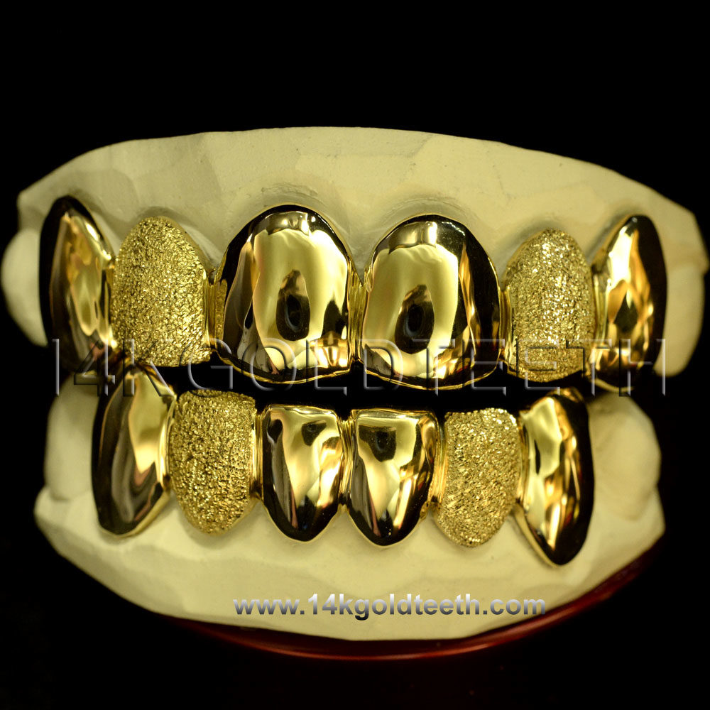 Silver Diamond Dust and Solid Grillz with 18k Yellow Gold Plated - SP 106