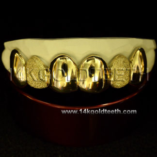 Diamond Dust Yellow Gold Teeth Grillz - DD 90022