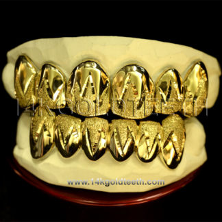 Diamond Dust Yellow Gold Teeth Grillz - DD 90010