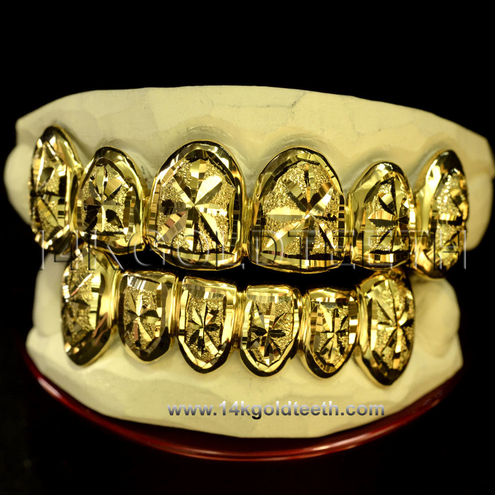 Top & Bottom Yellow Gold Teeth Grillz - TBY 30013