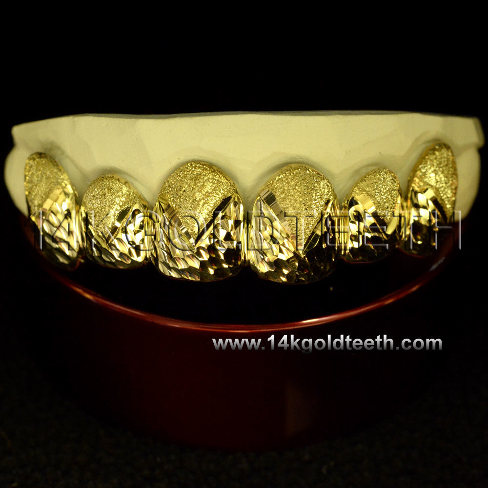 Diamond Dust Yellow Gold Teeth Grillz - DD 90016