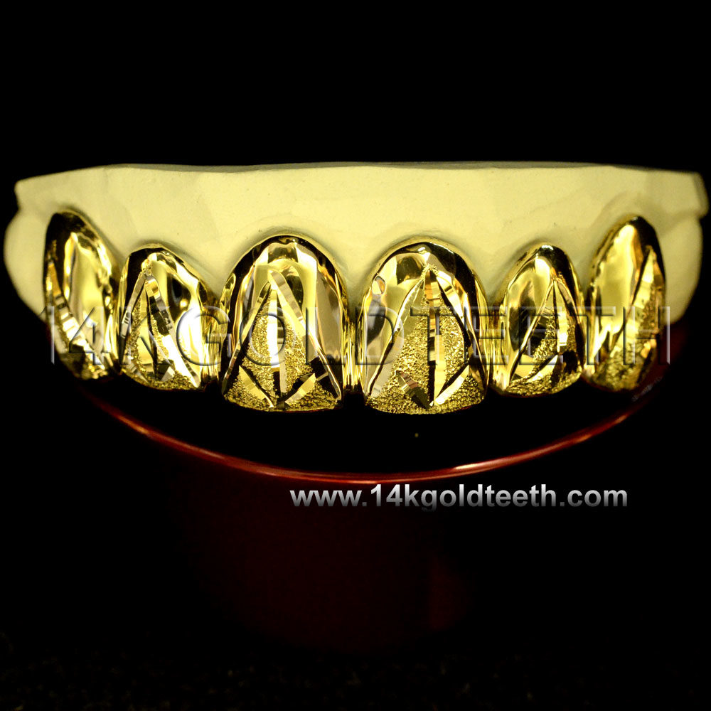 Diamond Dust Yellow Gold Teeth Grillz - DD 90014