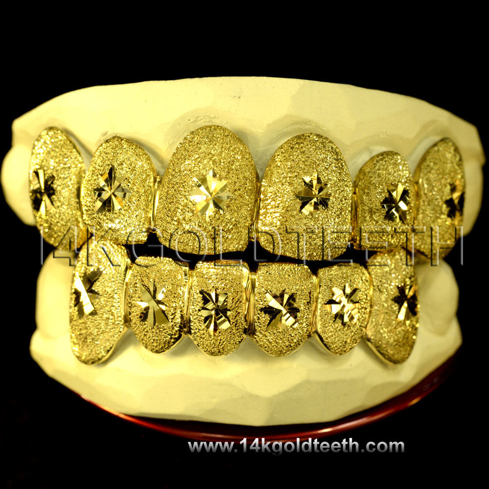 Top & Bottom Yellow Gold Teeth Grillz - TBY 30005