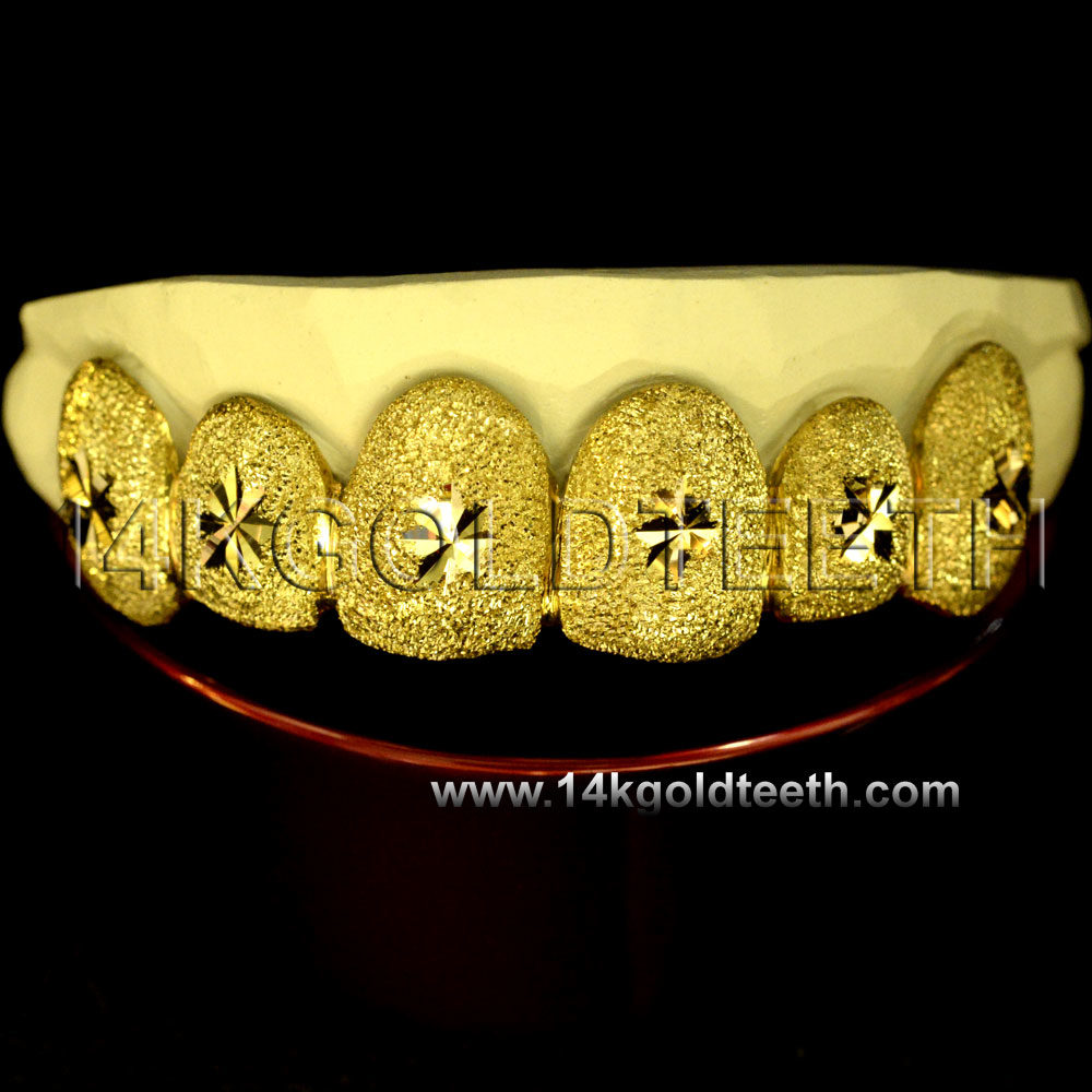 Diamond Dust Yellow Gold Teeth Grillz - DD 90012