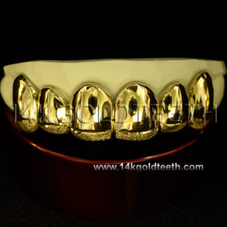 Diamond Dust Yellow Gold Teeth Grillz - DD 90015