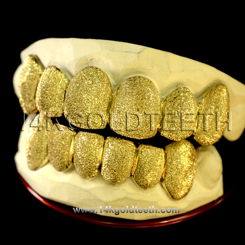 Silver Diamond Dust Grillz with 18k Yellow Gold Plated - SP 103