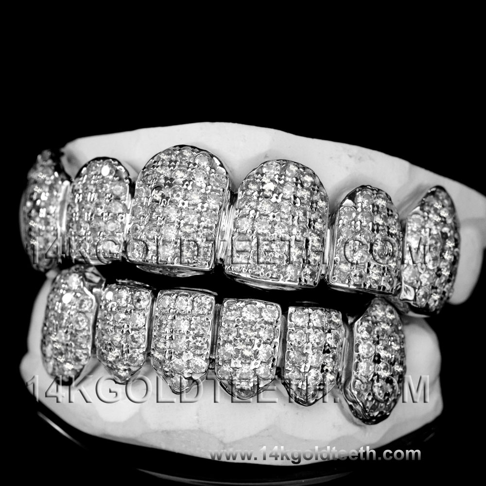 Iced Out Silver Grillz - ICS 40305