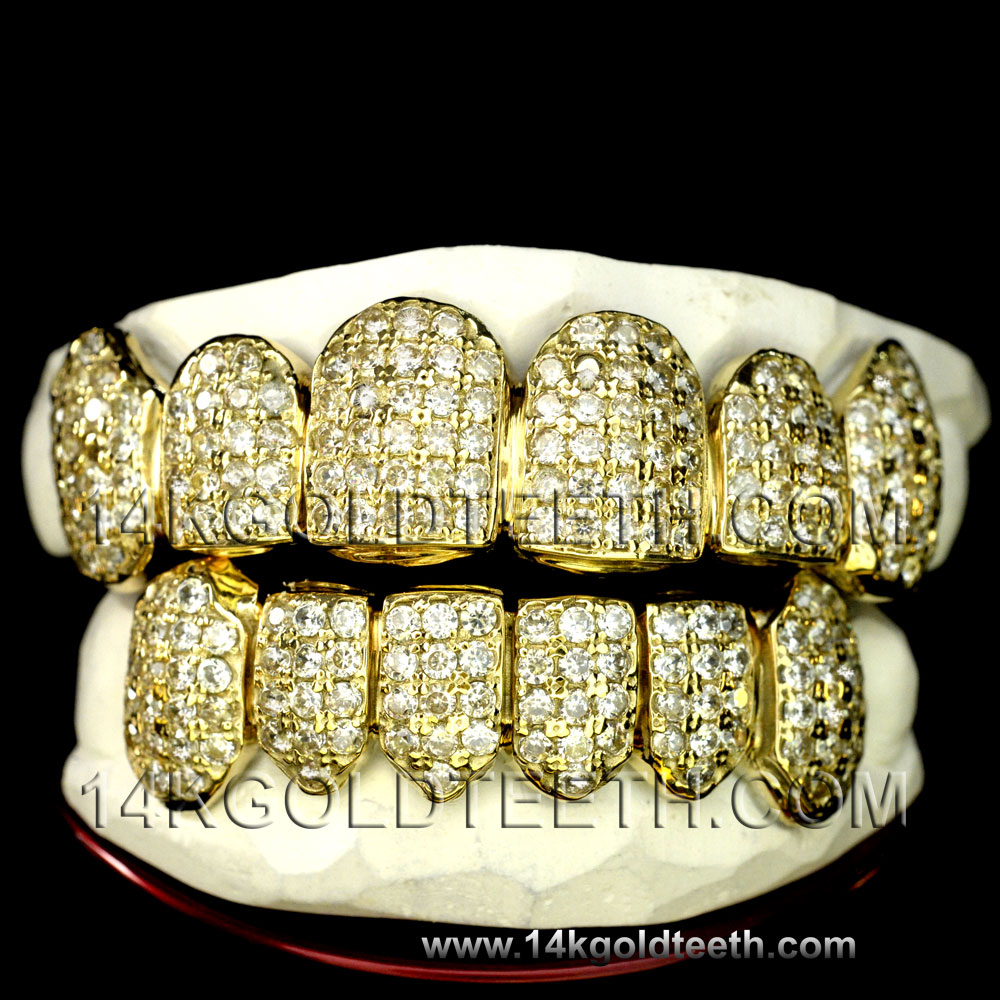 Iced Out  Yellow Gold Teeth Grillz - IC 40005