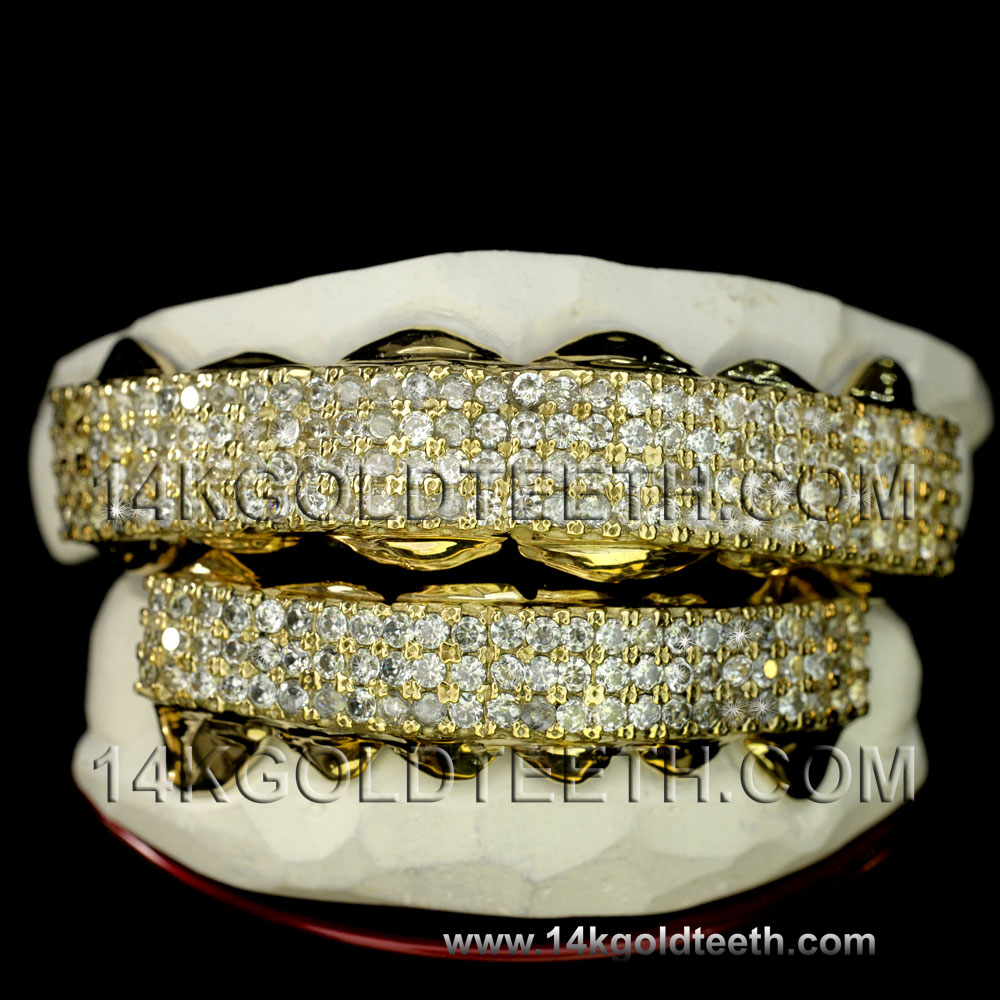 Iced Out  Yellow Gold Teeth Grillz - IC 40006