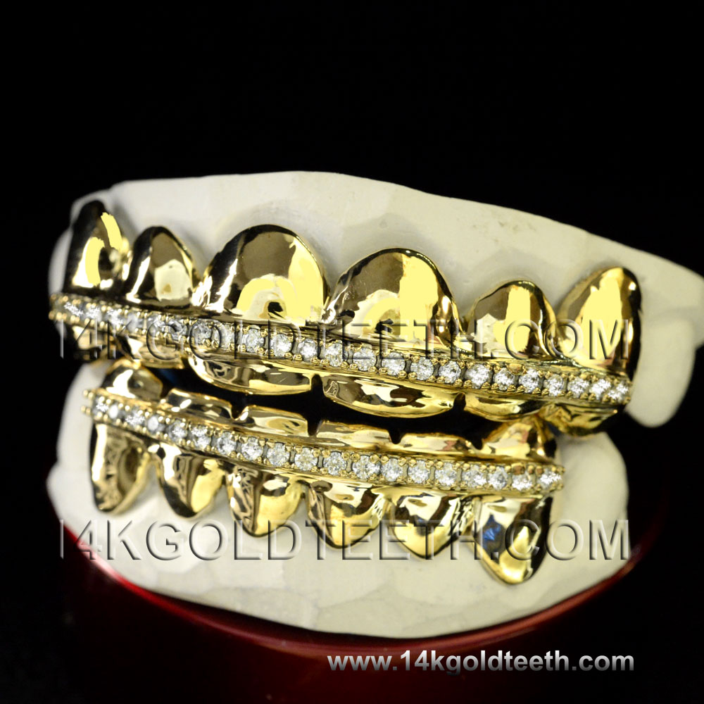 Iced Out  Yellow Gold Teeth Grillz - IC 40003