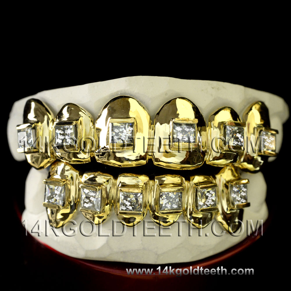 Iced Out  Yellow Gold Teeth Grillz - IC 40004